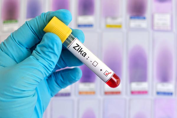 Test Tub Labeled Zika